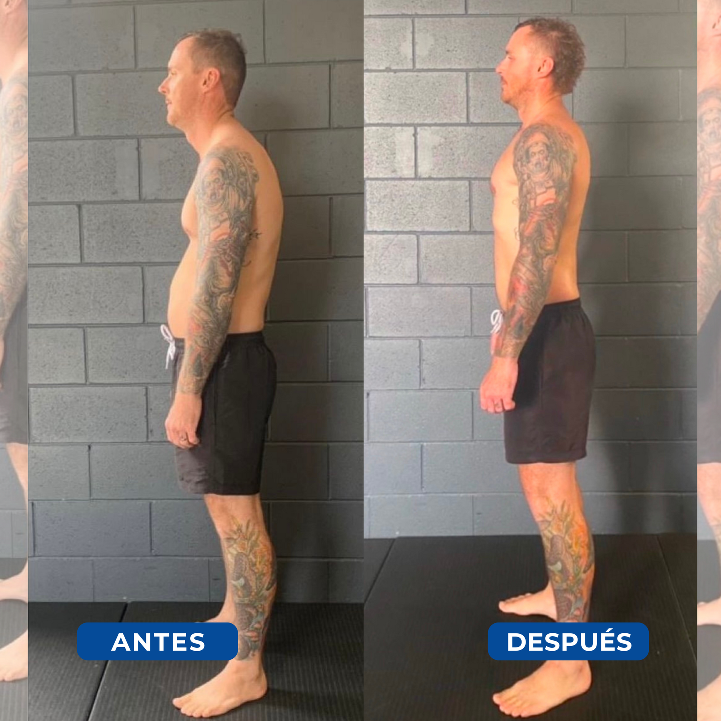 Corrector Postural Ortopédico - PosturePro™ [ Envío Gratís y Regalos Exclusivos! ]