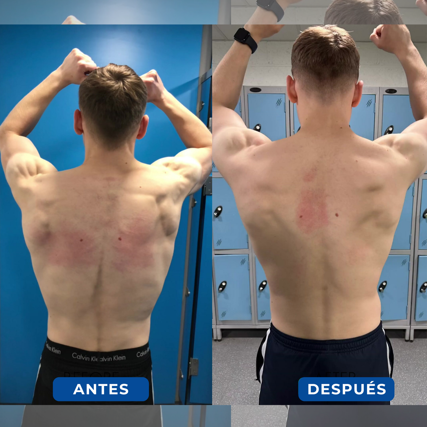 Corrector Postural Ortopédico - PosturePro™ [ Envío Gratís y Regalos Exclusivos! ]