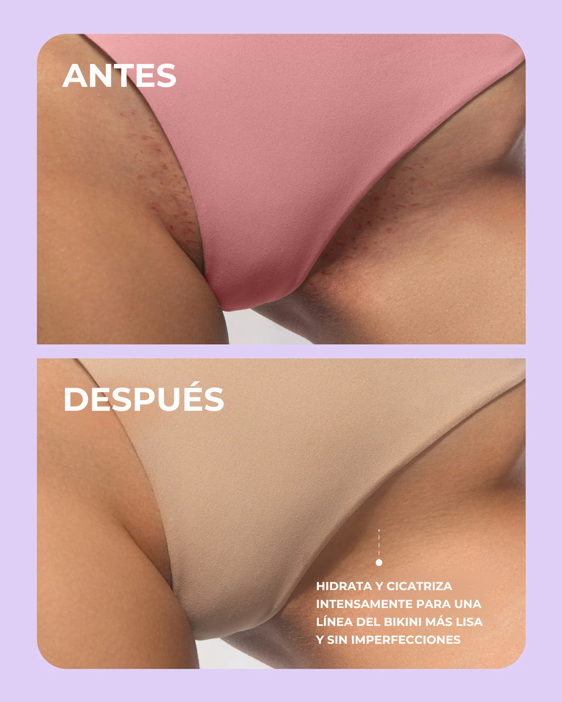 Original Aceite Premium Truly - Piel más clara al instante + Envío Gratís y Regalos Exclusivos!